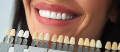 Советы до отбеливания зубов ZOOM 4